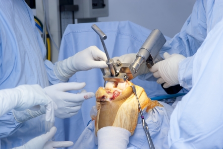 knee replacement surgery in hsr layout, Bangalore