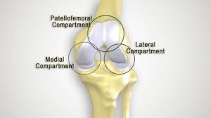 Partial Knee Replacement in hsr layout, bangalore